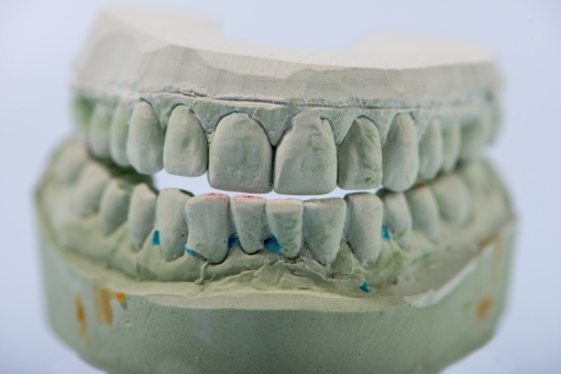 Green cast of my teeth - close up